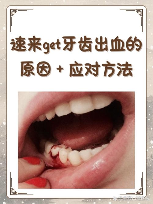 缓解牙龈出血：刷牙出血怎么办，饮食和护理改善方法​