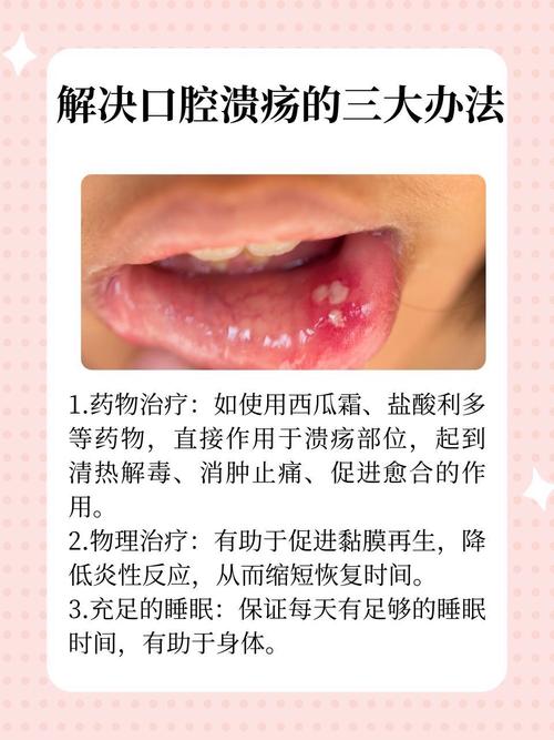 儿童口腔溃疡护理:饮食忌口,止痛愈合方法